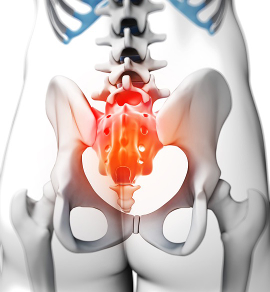 Bel Ağrısı Kuyruk Sokumu Belirtileri ve Tedavisi